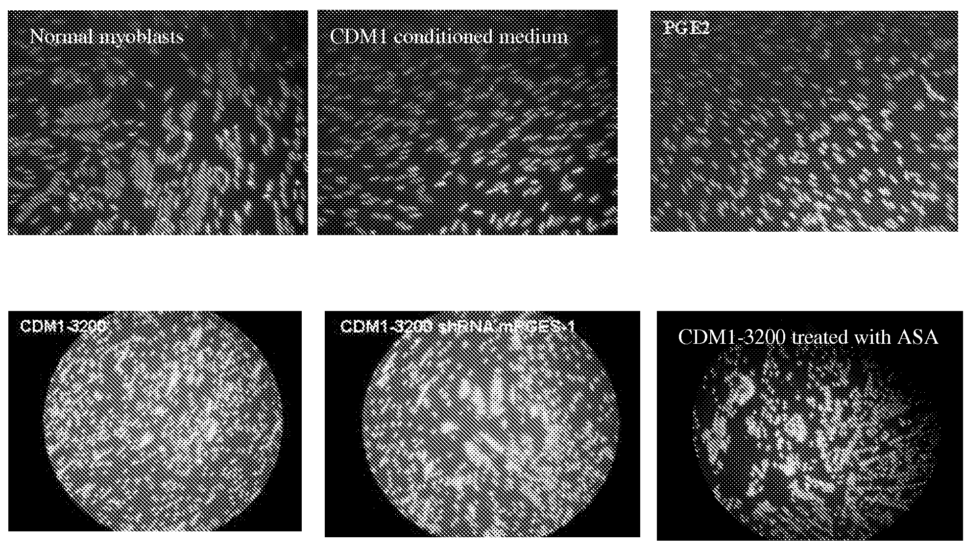 Prostaglandin e2 modulation and uses thereof