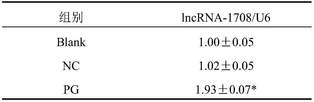 Application of high expression of lncRNA in inhibiting aging of umbilical cord mesenchymal stem cells