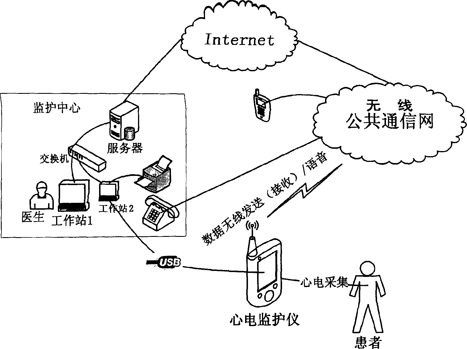 Radio remote monitoring system for cardiogram