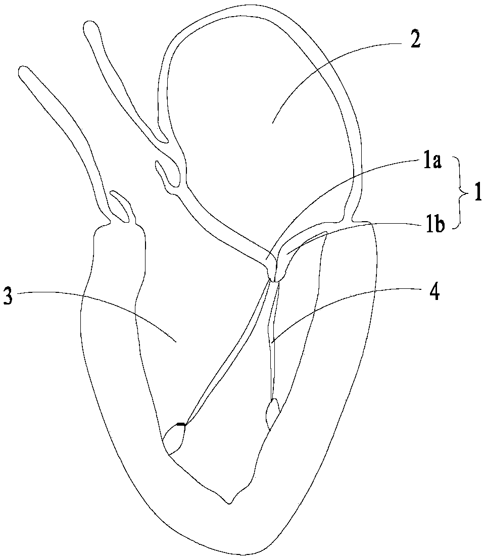 Valve clamping device and valve clamping system