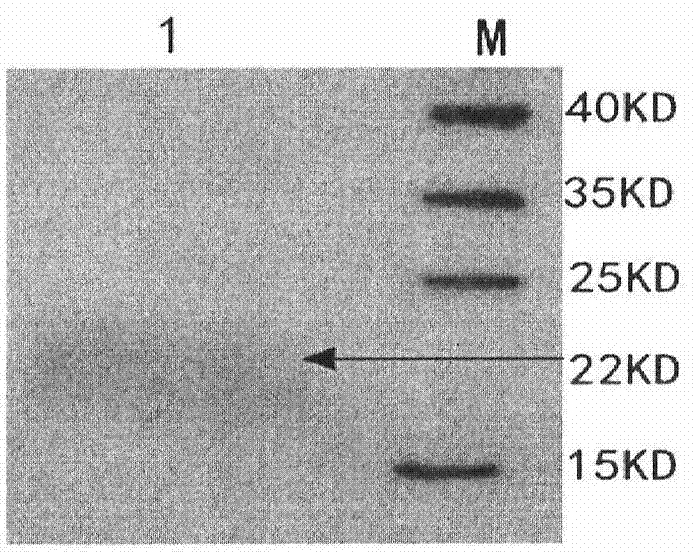 Bacteriophage lysin with improved antibacterial effect