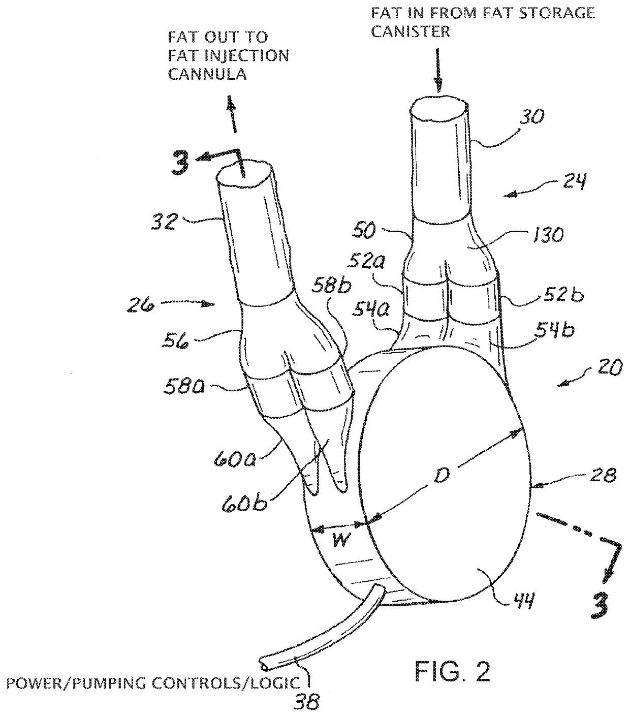 A system for the harvest and transfer for high volume fat grafting using a centrifugal pump