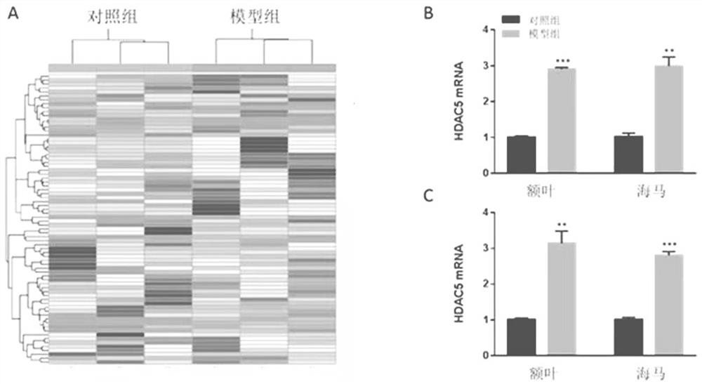 HDAC5 as a peripheral marker in a rat model of progeny infected during pregnancy