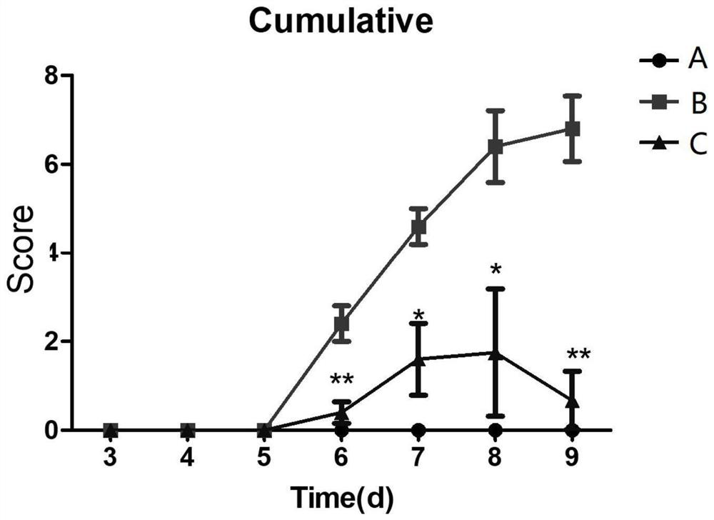 Application of gemcitabine in preparation of medicine for treating psoriasis, medicine and preparation method thereof