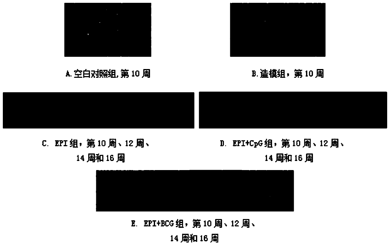 Method for treating bladder cancer through promoting pharmorubicin by bacillus calmette guerin vaccine