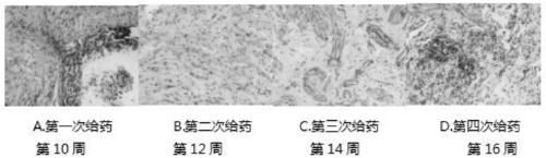 Method for treating bladder cancer through promoting pharmorubicin by bacillus calmette guerin vaccine