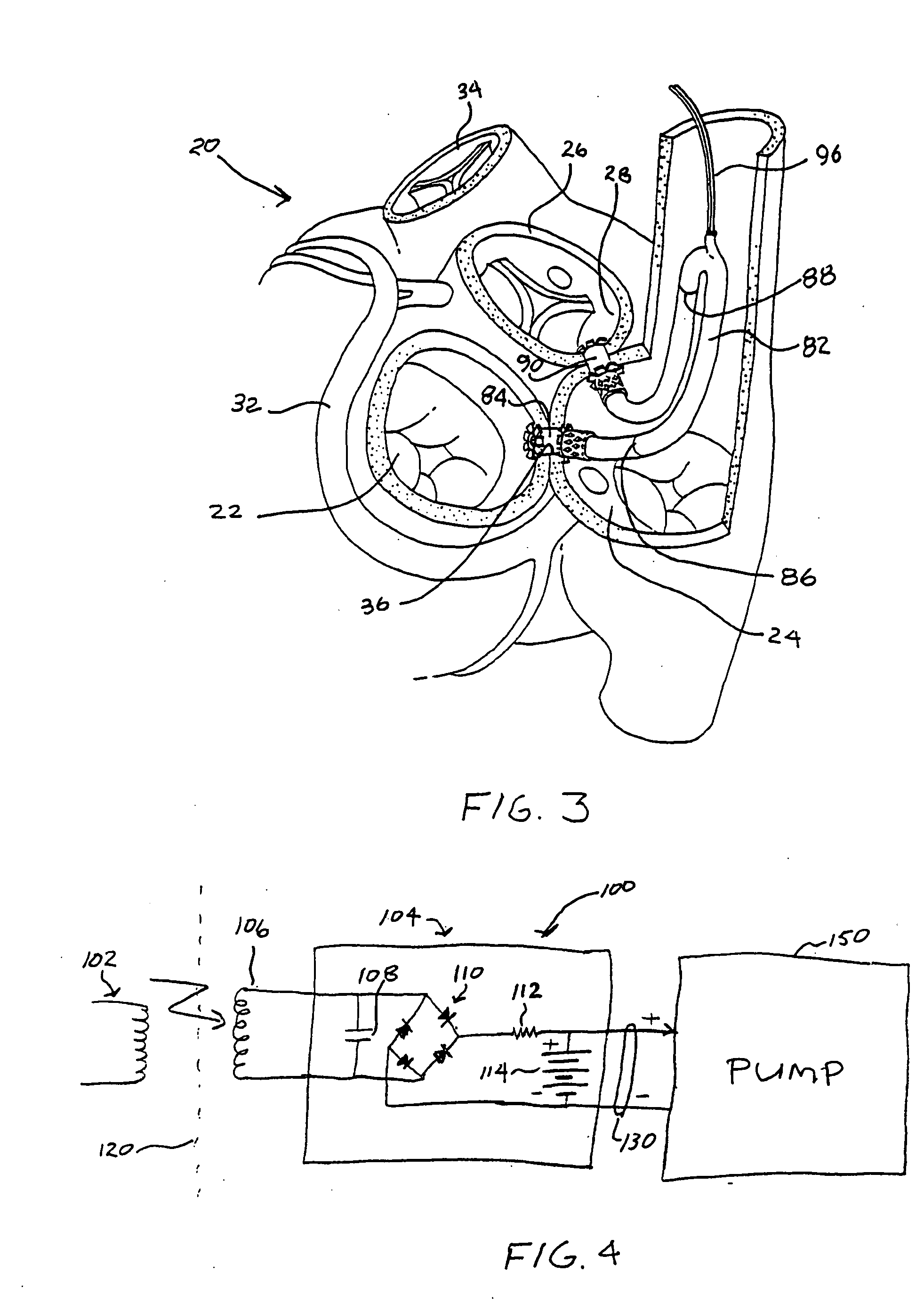 Left ventricular function assist system and method