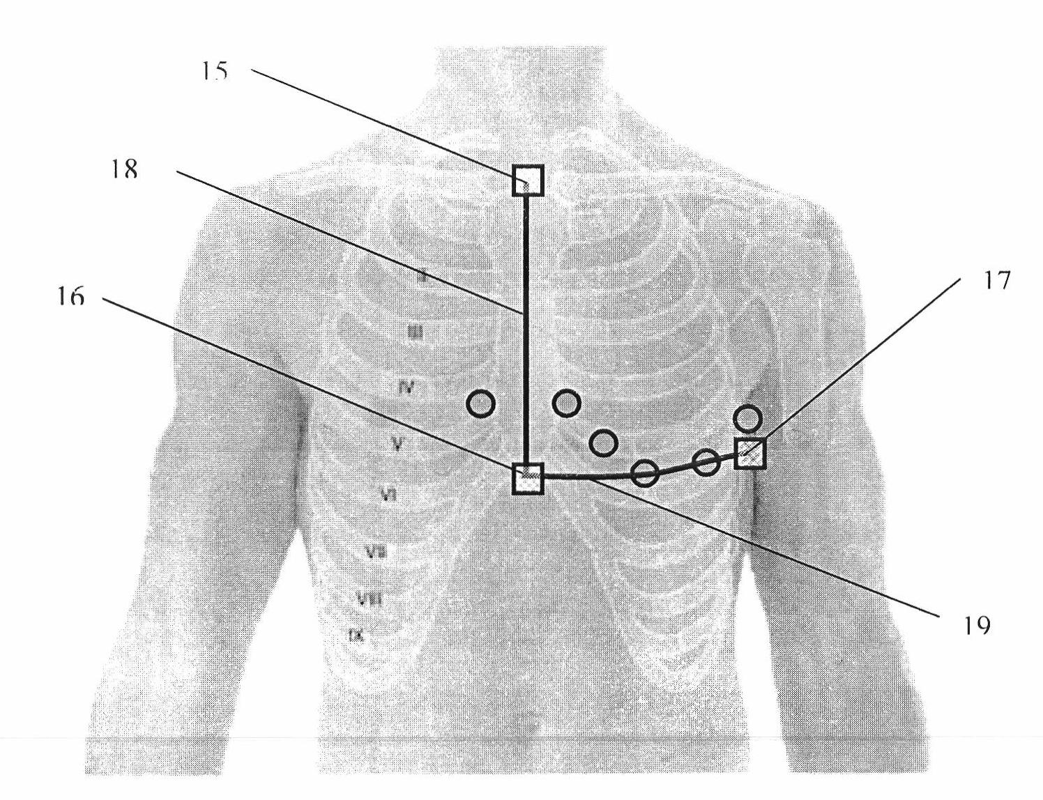 Method and device for arranging and positioning electrocardio-electrode