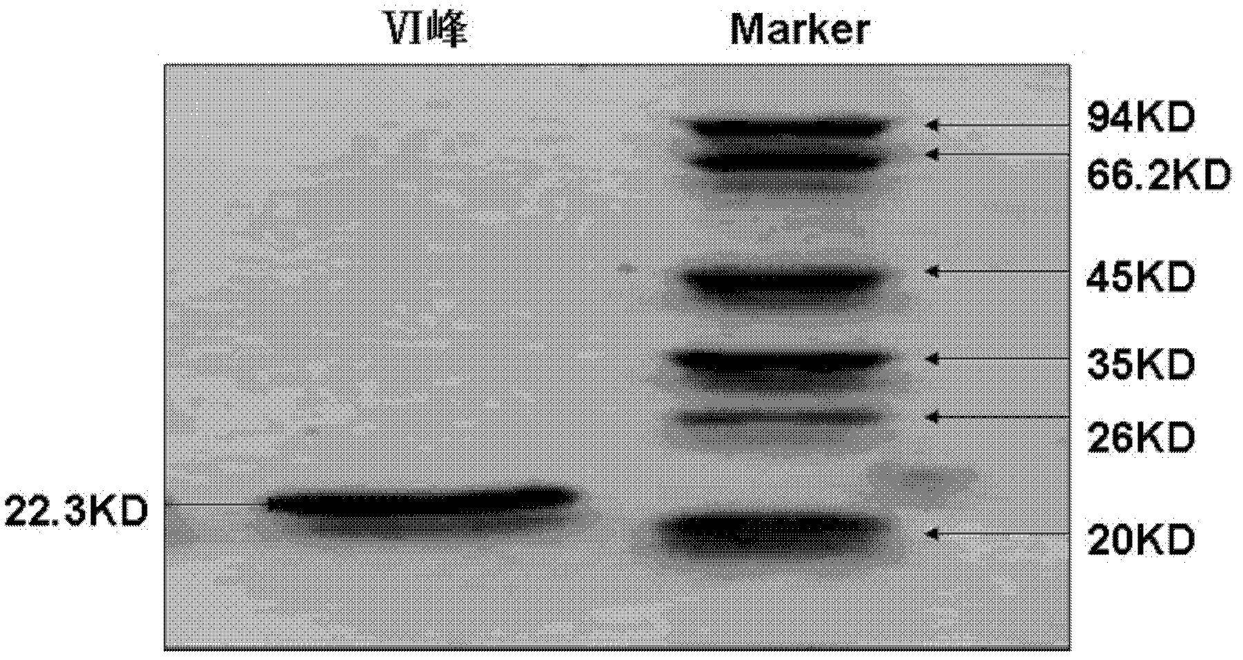 Application of cobra venom nerve growth factor in preparing the medicine of preventing and treating liver fibrosis and liver cirrhosis