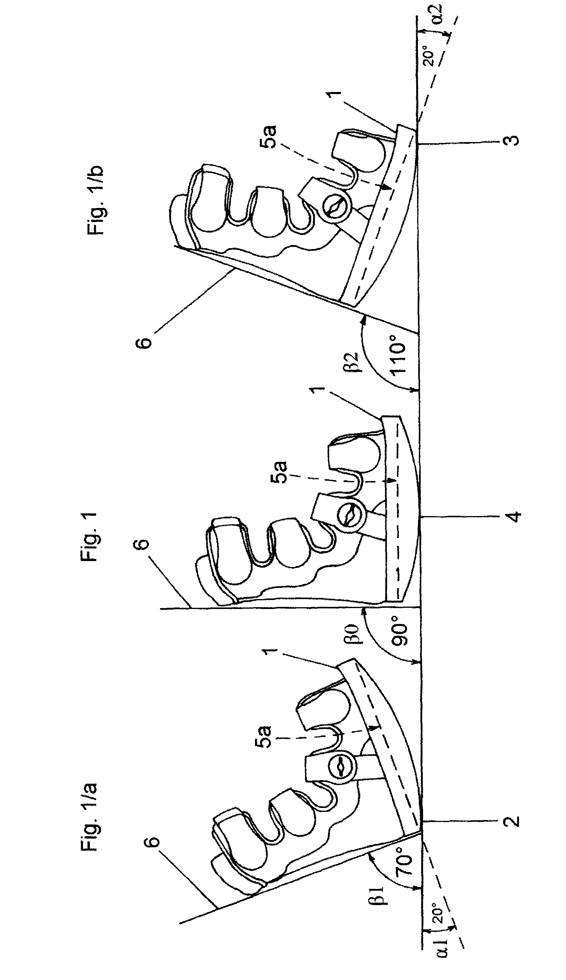 Footwear orthosis