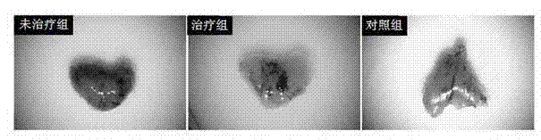 Mesenchymal stem cell and application thereof in resisting HIV-1 (human immunodeficiency virus)