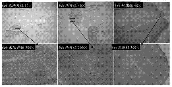 Mesenchymal stem cell and application thereof in resisting HIV-1 (human immunodeficiency virus)