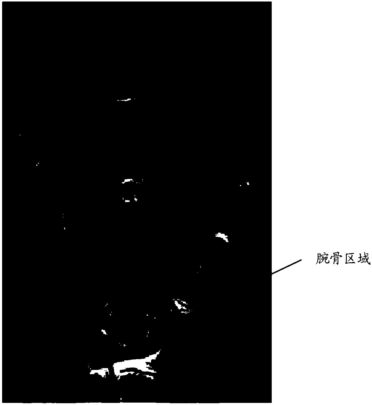 A method and apparatus for detecting bone age