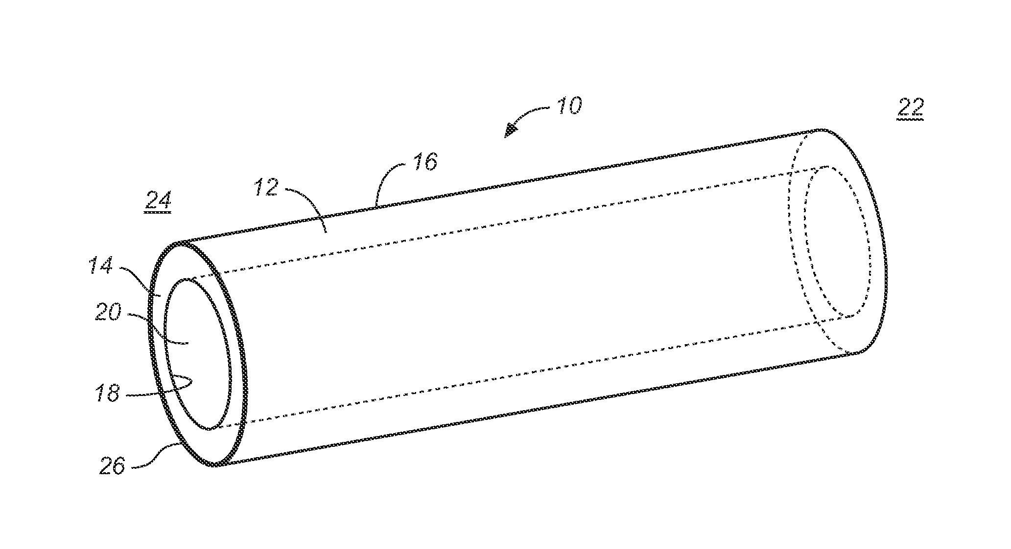 Photocatalytic disinfection of implanted catheters