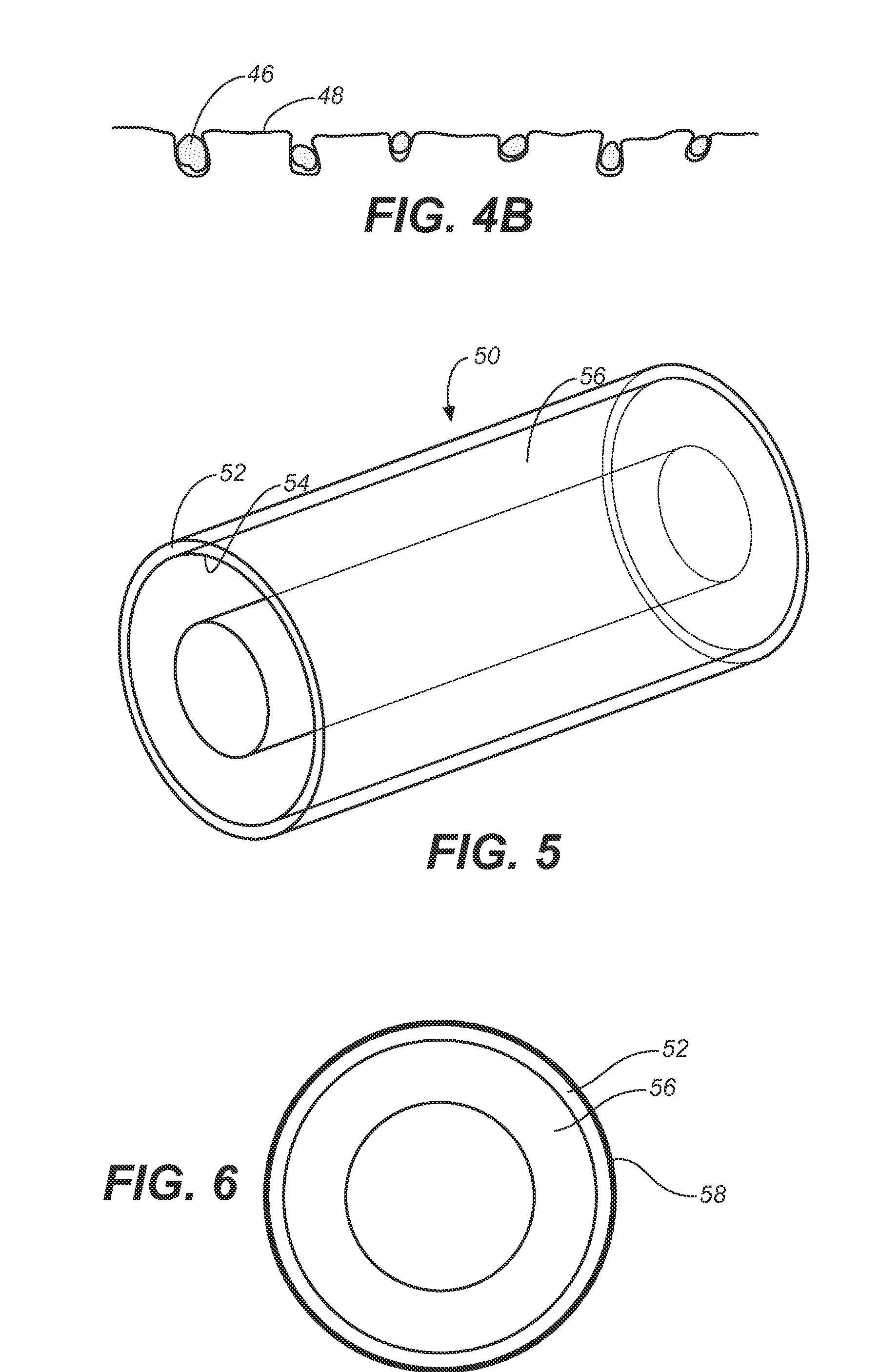 Photocatalytic disinfection of implanted catheters