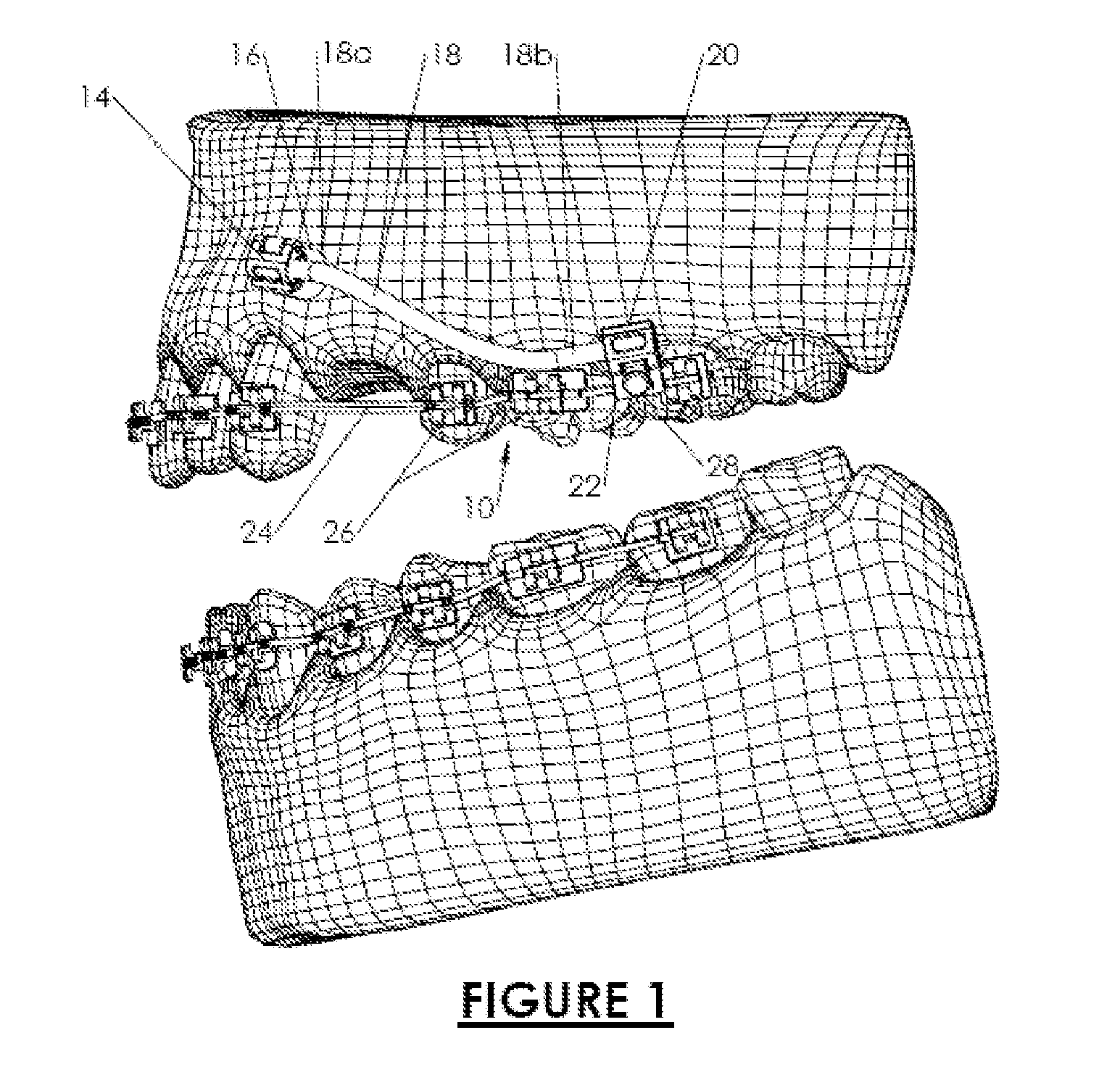 Orthodontic appliance anchoring method and apparatus