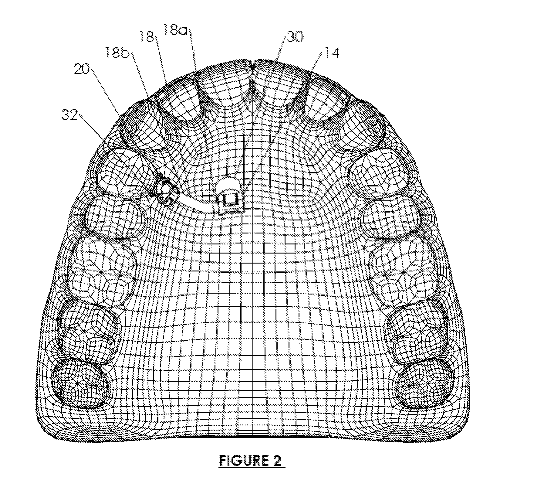 Orthodontic appliance anchoring method and apparatus