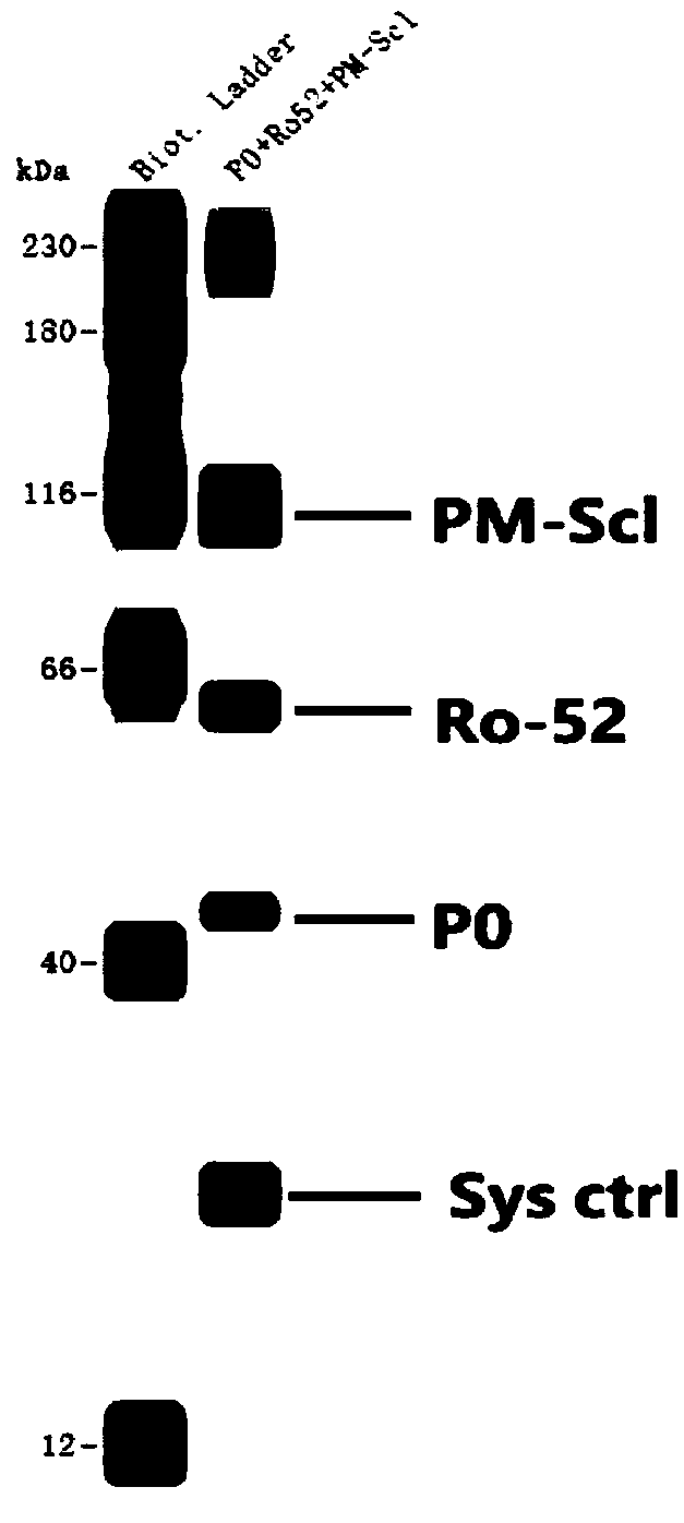 Detection method for rapidly and quantitatively detecting content of antinuclear antibody