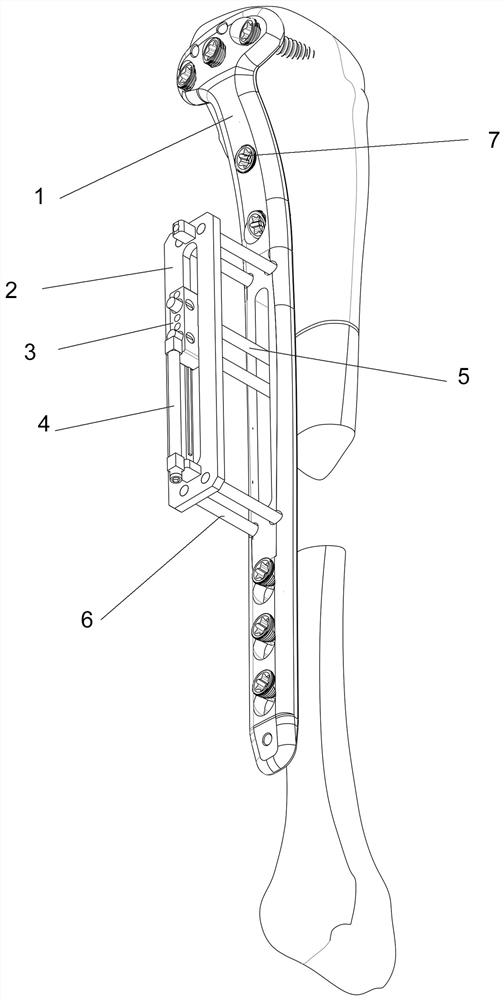 Long bone locking steel plate traction external fixator and using method thereof