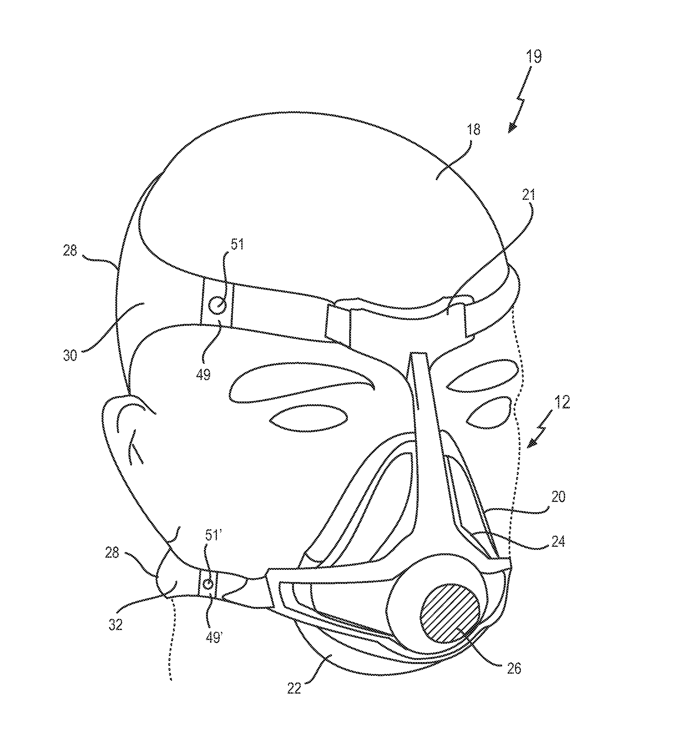 Fixation control for a patient interface