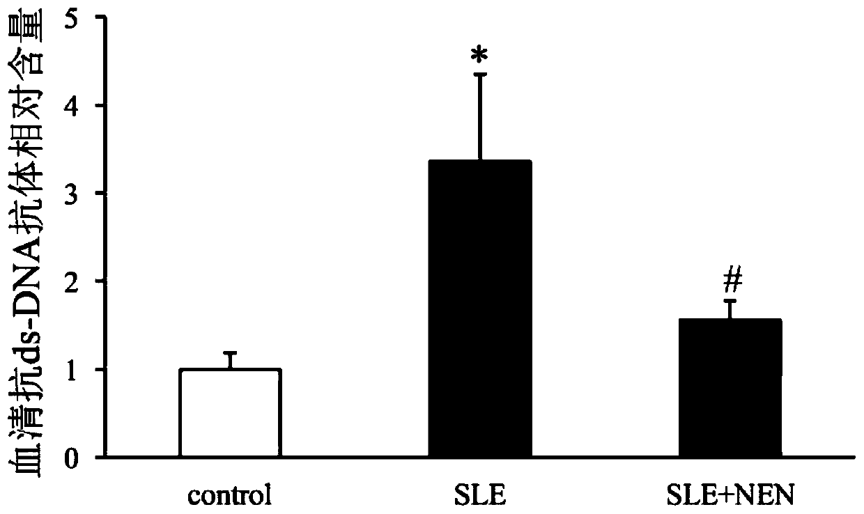 Application of niclosamide ethanolamine salt in preparation of medicine for treating systemic lupus erythematosus and complications thereof