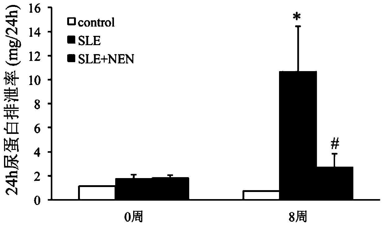 Application of niclosamide ethanolamine salt in preparation of medicine for treating systemic lupus erythematosus and complications thereof