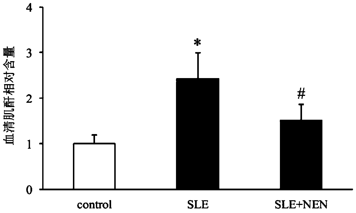 Application of niclosamide ethanolamine salt in preparation of medicine for treating systemic lupus erythematosus and complications thereof