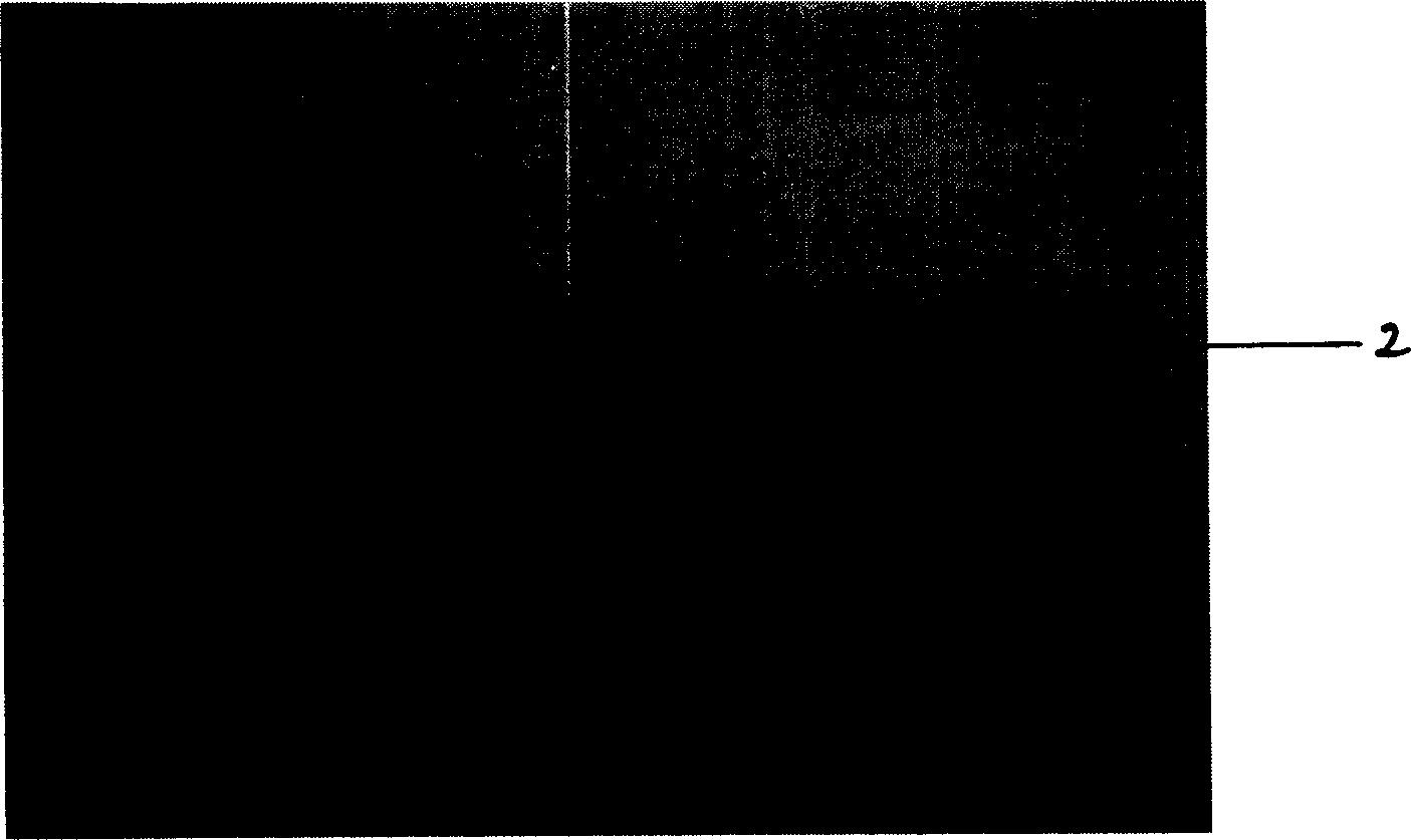 Artificial endovascular stent and preparation method thereof