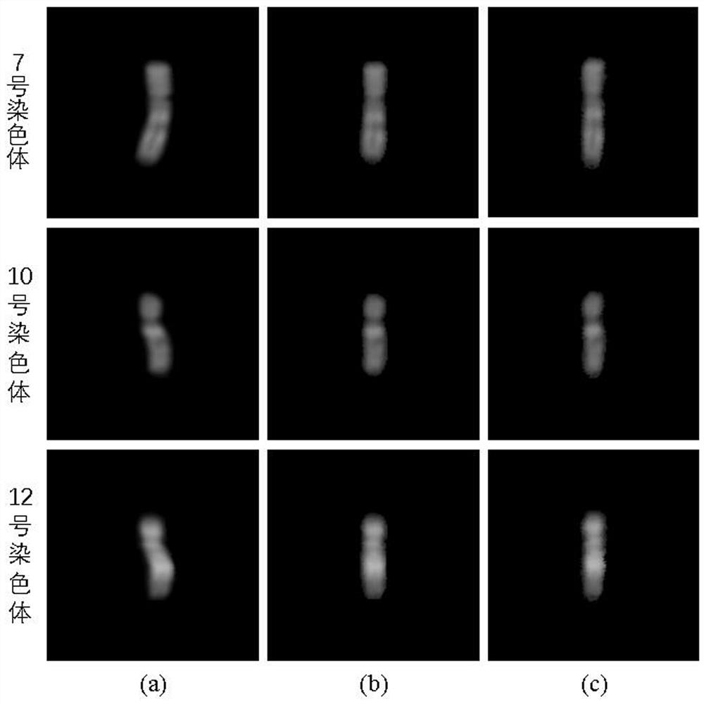 Bent chromosome image straightening method based on joint model