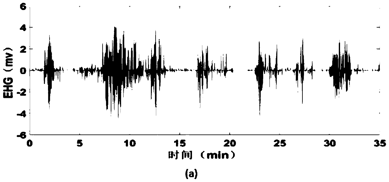 Method for automatically identifying uterine contraction based on uterus electromyographic signal