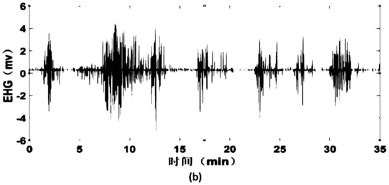 Method for automatically identifying uterine contraction based on uterus electromyographic signal