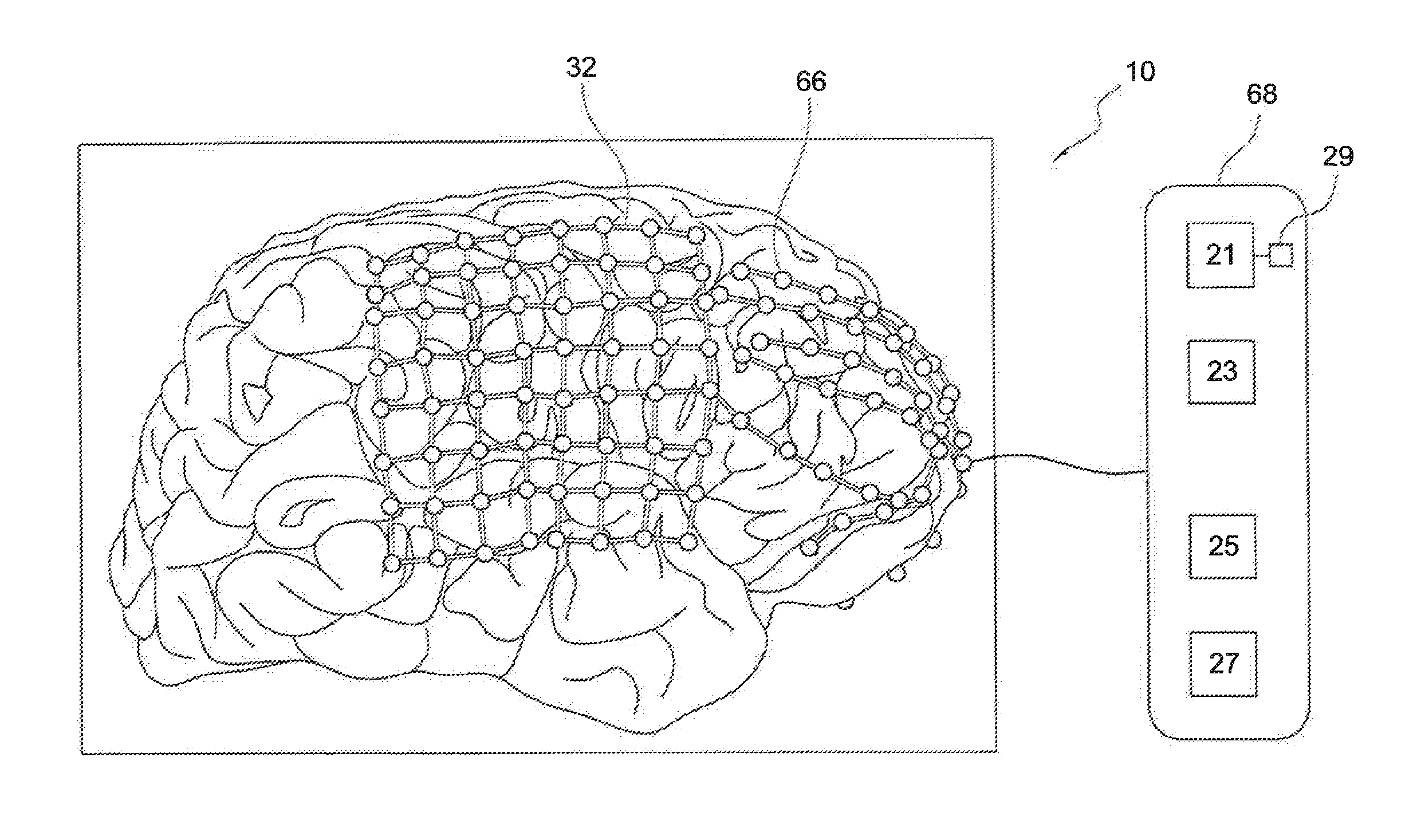 Brain cooling system