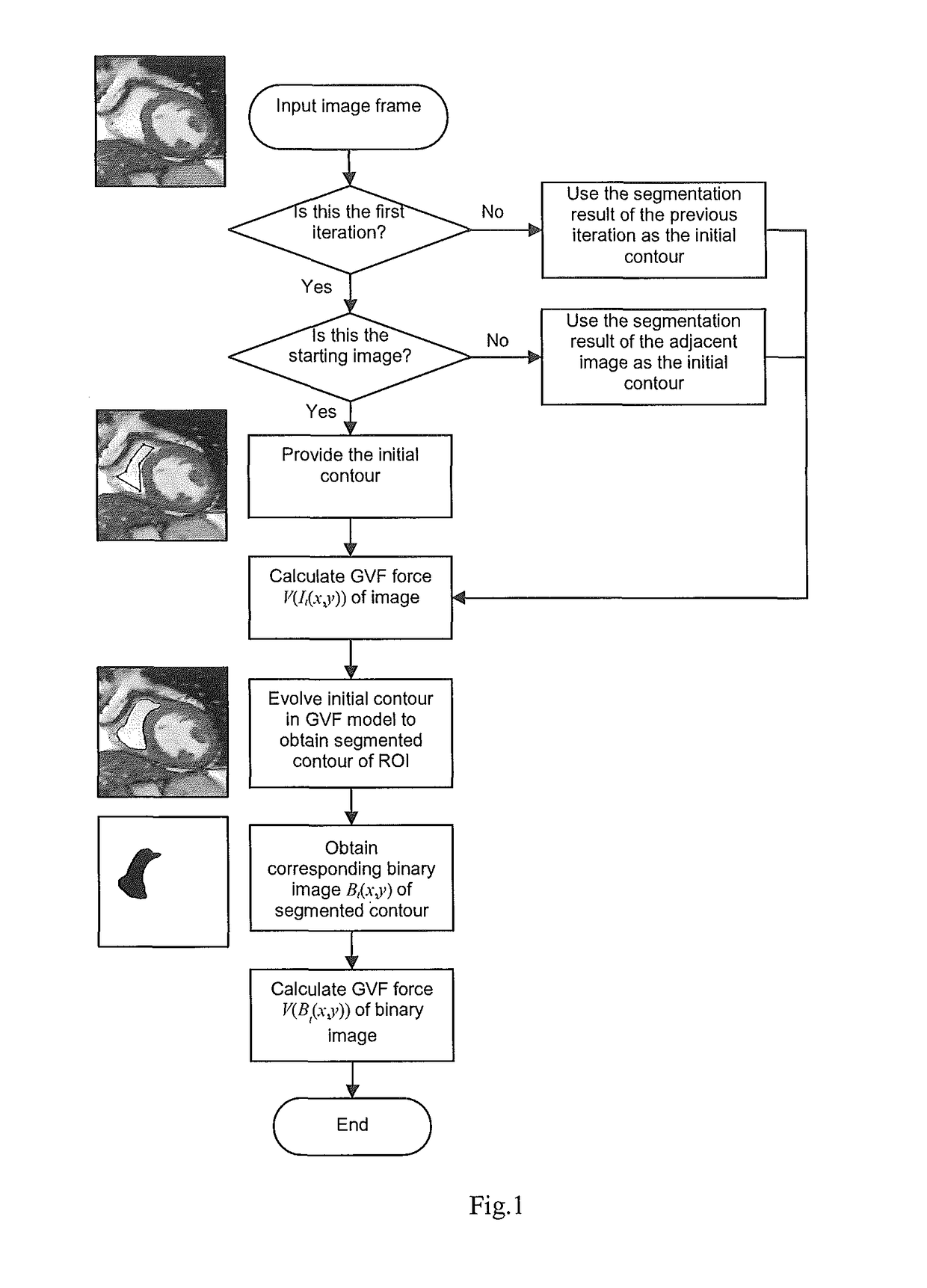 Segmentation of cardiac magnetic resonance (CMR) images using a memory persistence approach