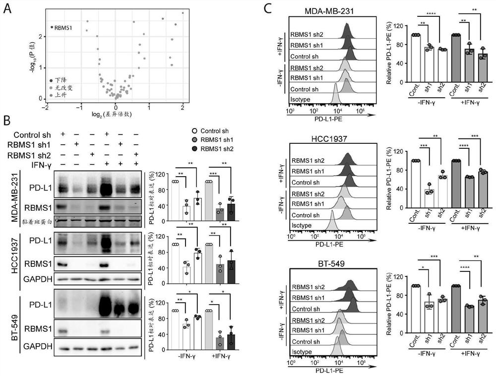 Application of RBMS1 knocking-down reagent in preparation of medicine for treating triple negative breast cancer