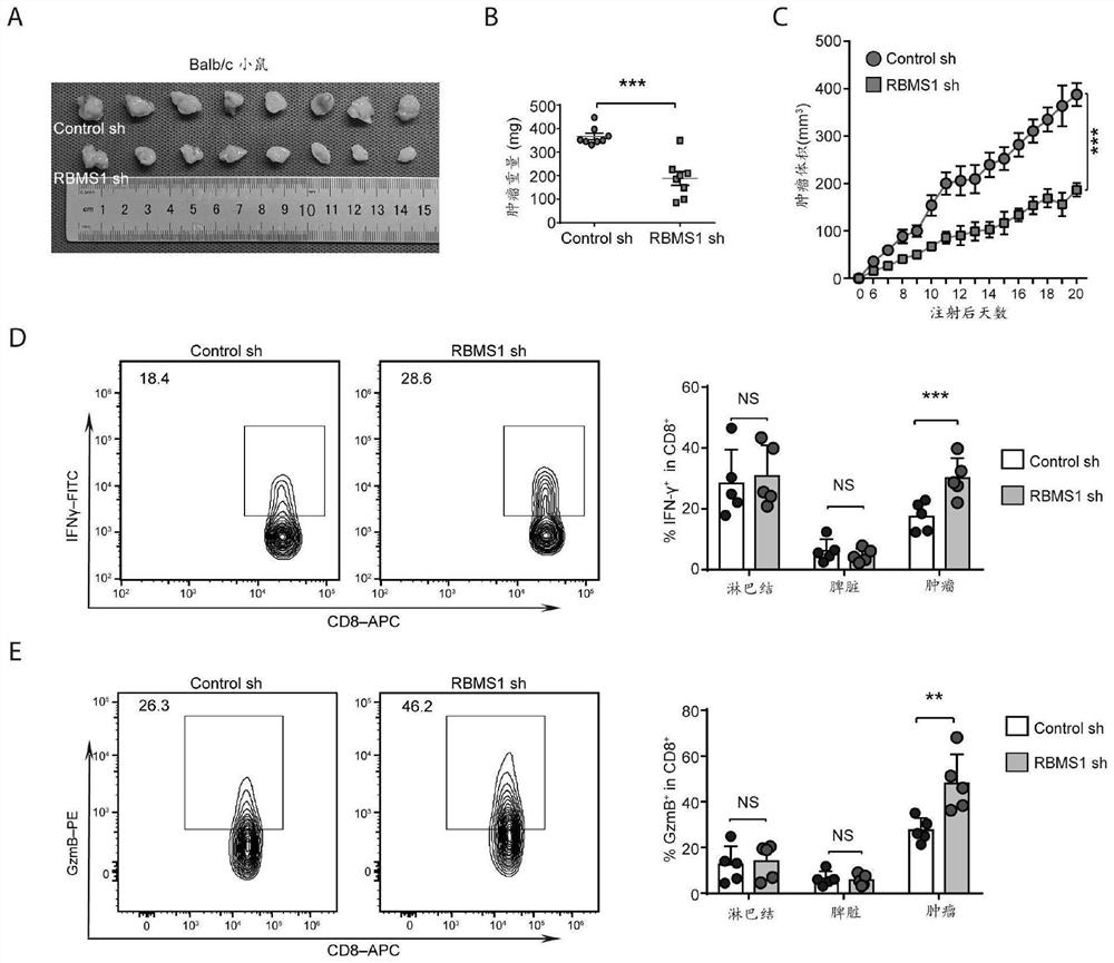 Application of RBMS1 knocking-down reagent in preparation of medicine for treating triple negative breast cancer