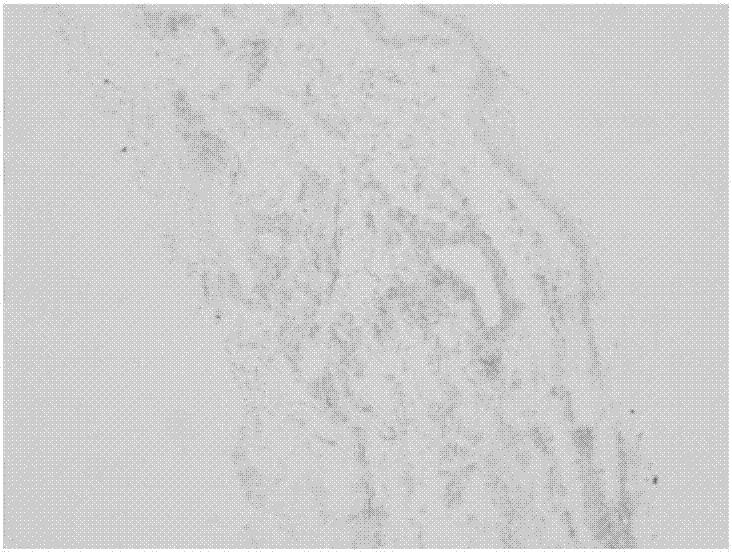 Method for preparing soft tissue decellular matrix through supercritical fluid technology