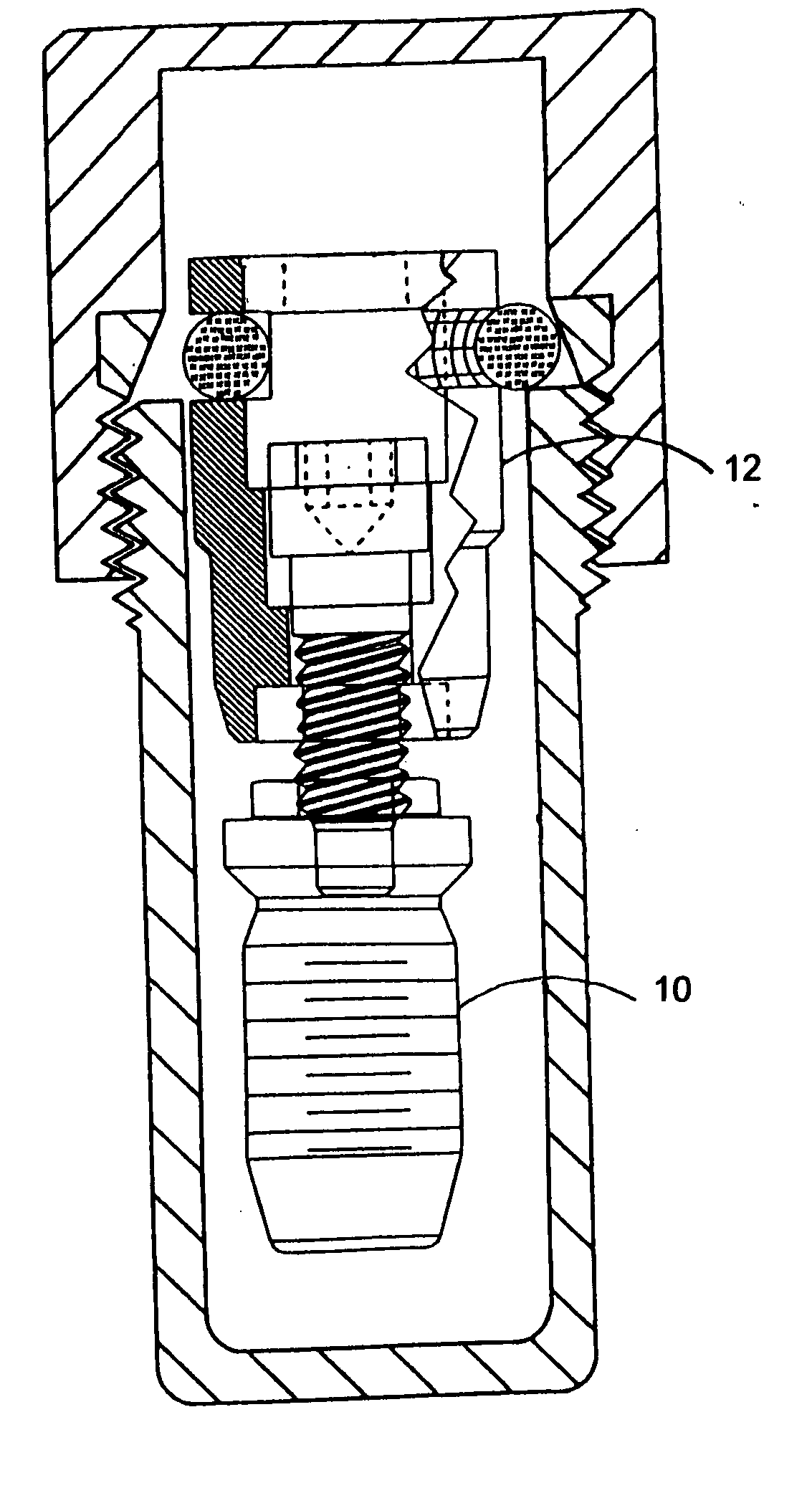 Implant delivery system