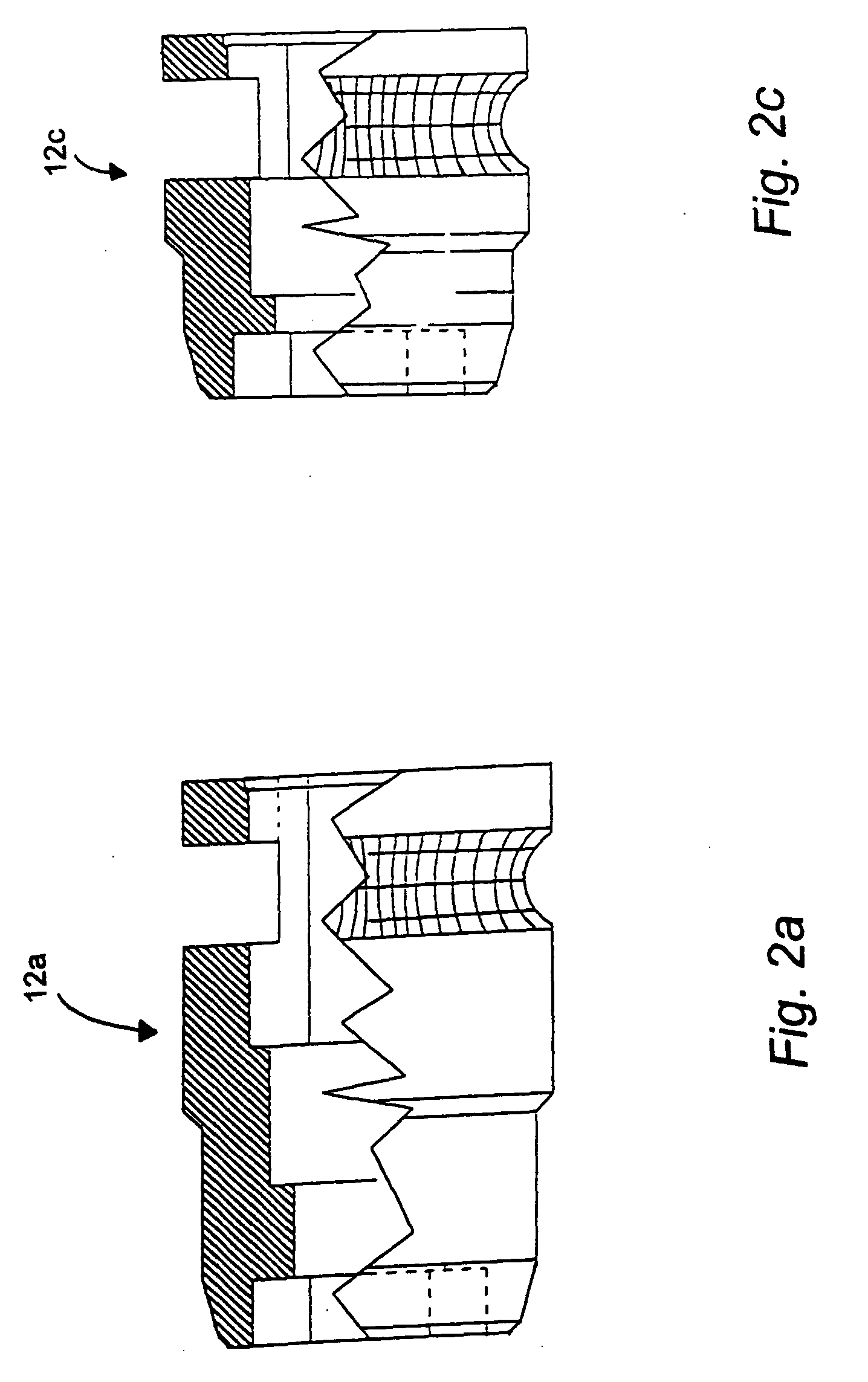 Implant delivery system