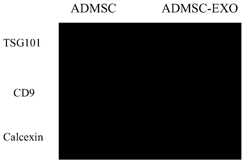 Intermittent hypoxia treated stem cell derived exosome and application in cardiac muscle tissue