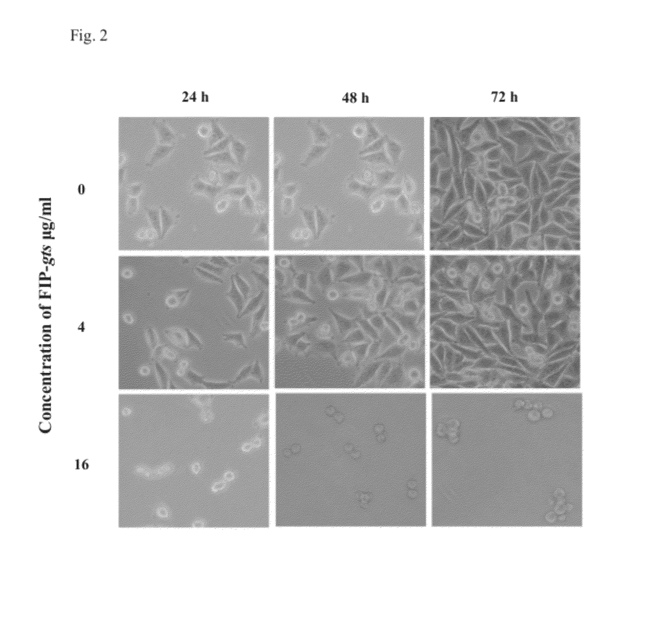 Compositions comprising fungal immunomodulatory protein and use thereof