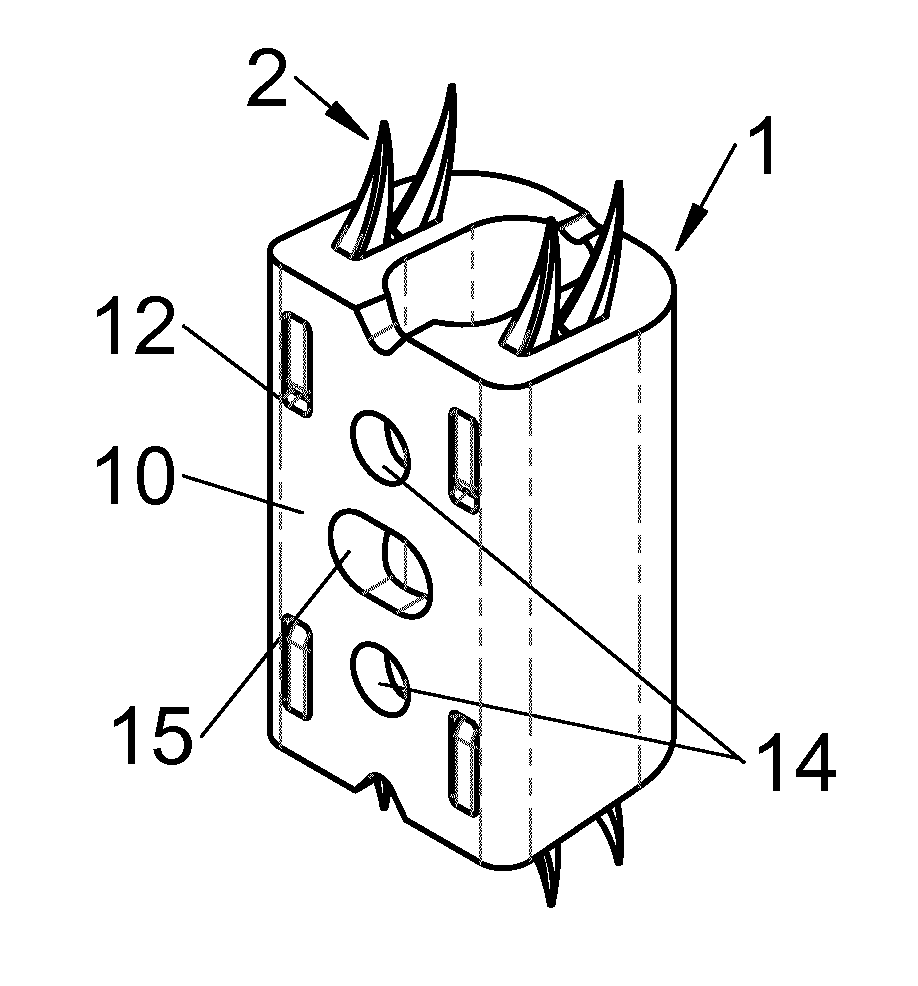 Vertebral implant, vertebral fastening device of the implant and implant instrumentation