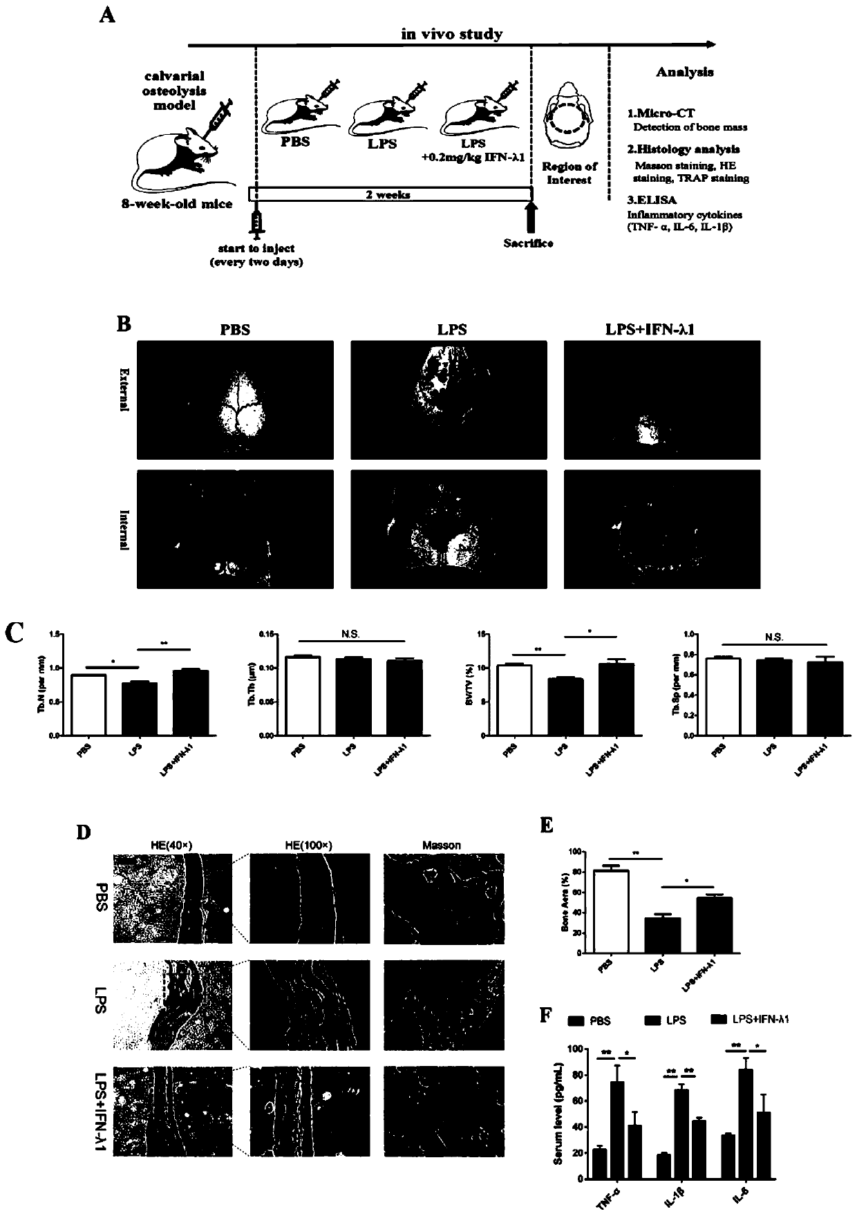 Application of recombinant IFN-lambda1 protein in preparation of a medicine for preventing and treating inflammation-induced bone loss