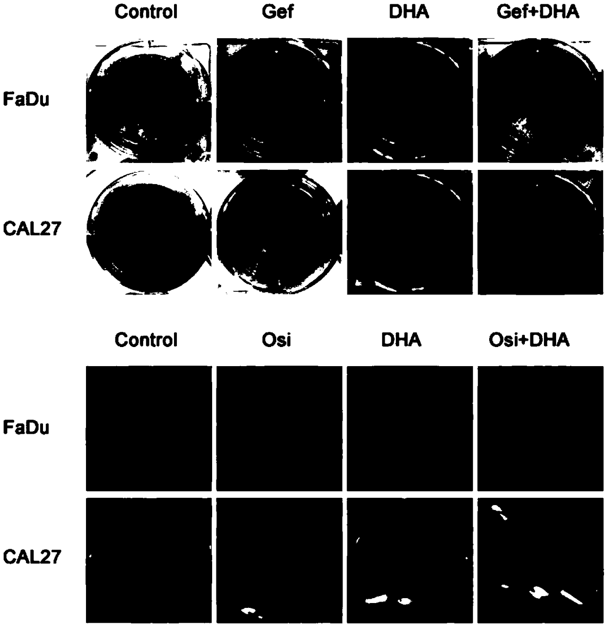 Application of composition of artemisinin or derivative thereof and EGFR-TKI targeted drug