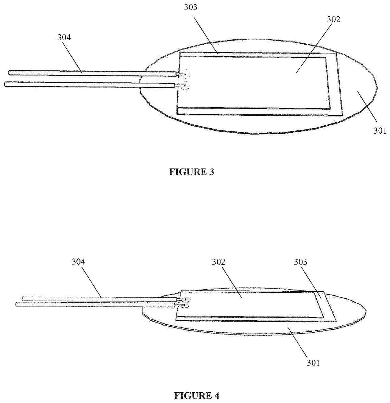 Sensor and apparatus for measurement of muscle activity in the detection and treatment of Bruxism Disorder