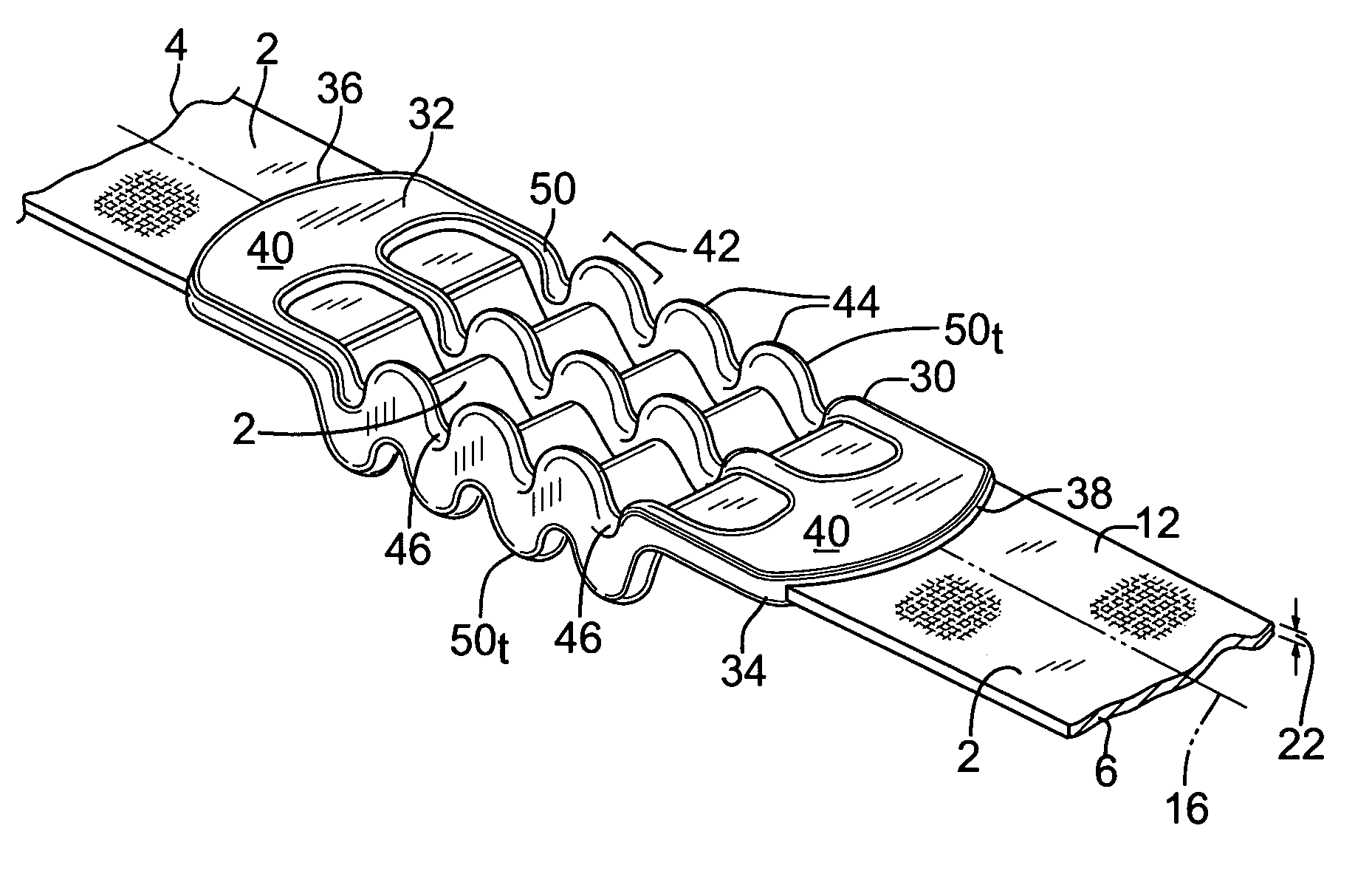 Shock-absorbing carrying strap