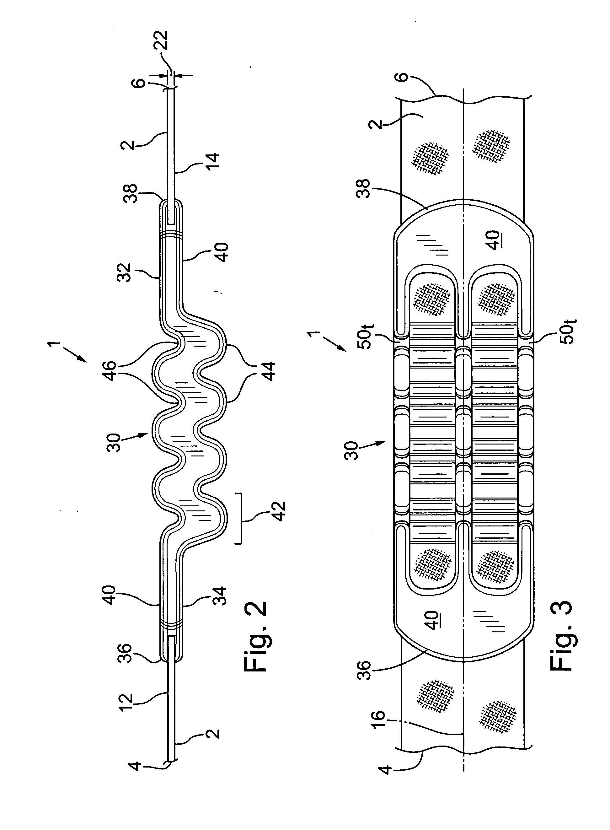 Shock-absorbing carrying strap