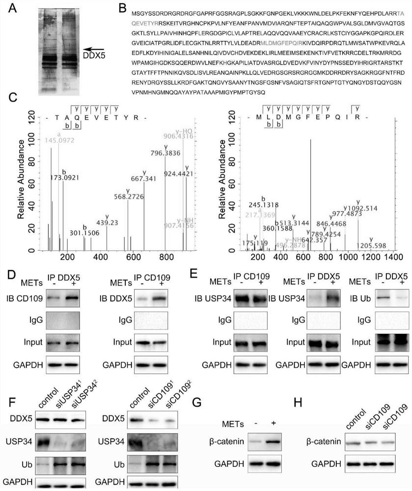 Application of METs as molecular marker in evaluation of clinical prognosis of glioma patient