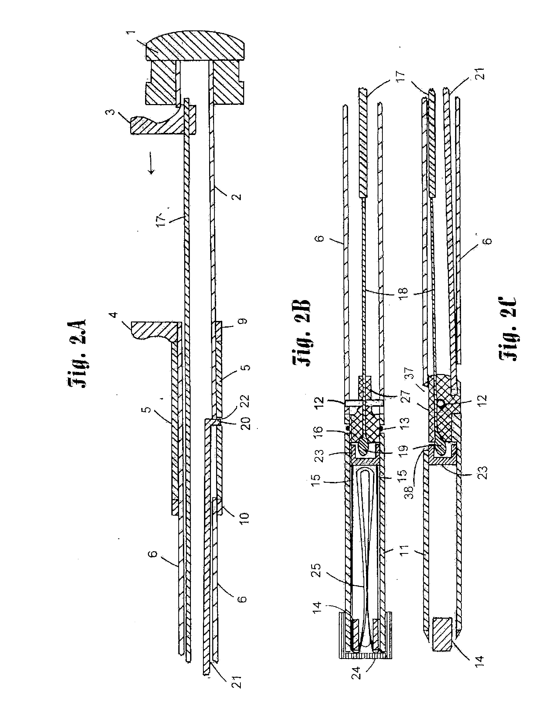 Transabdominal needle introducer