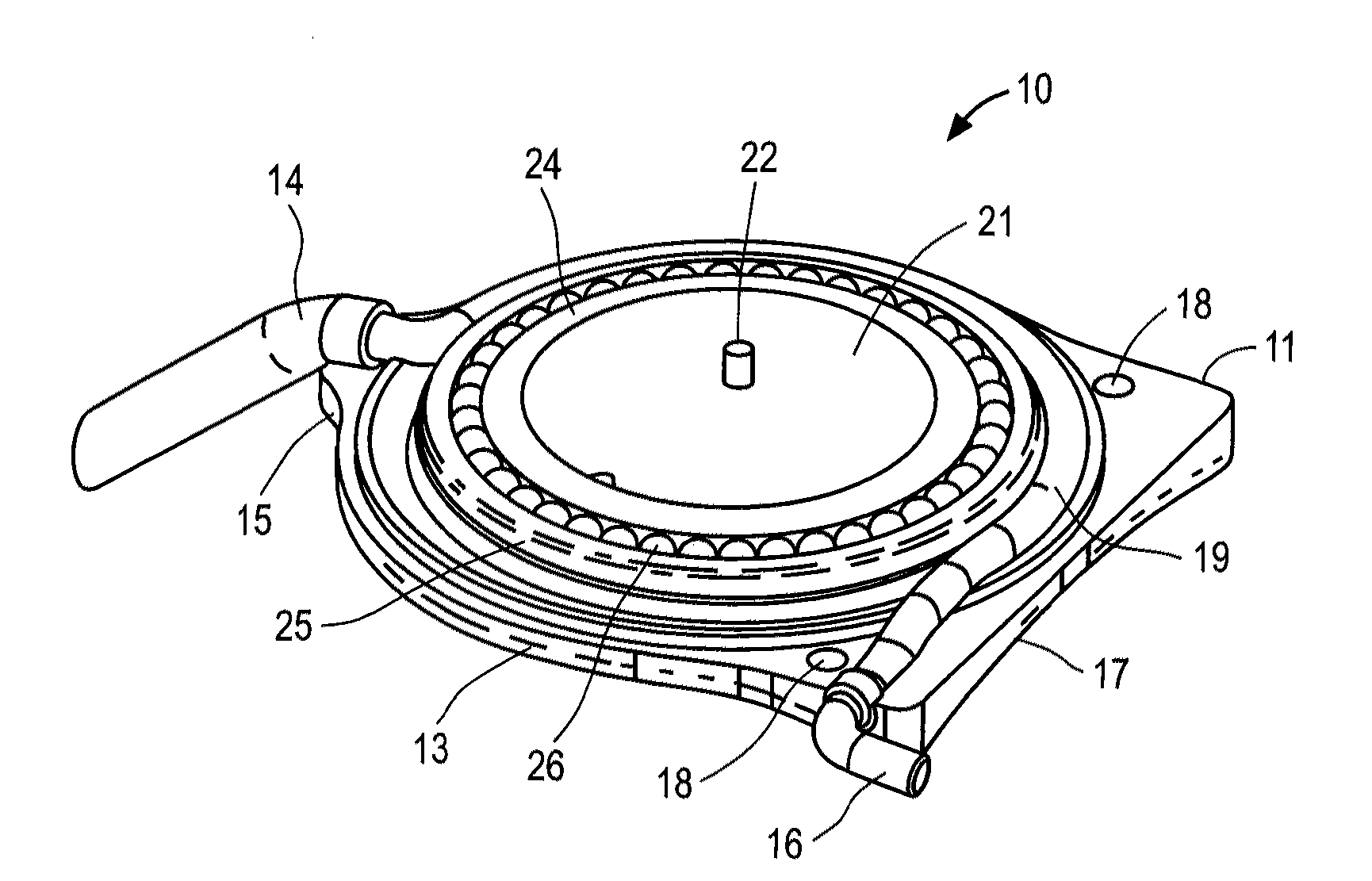 Apparatus and methods for treating excess intraocular fluid