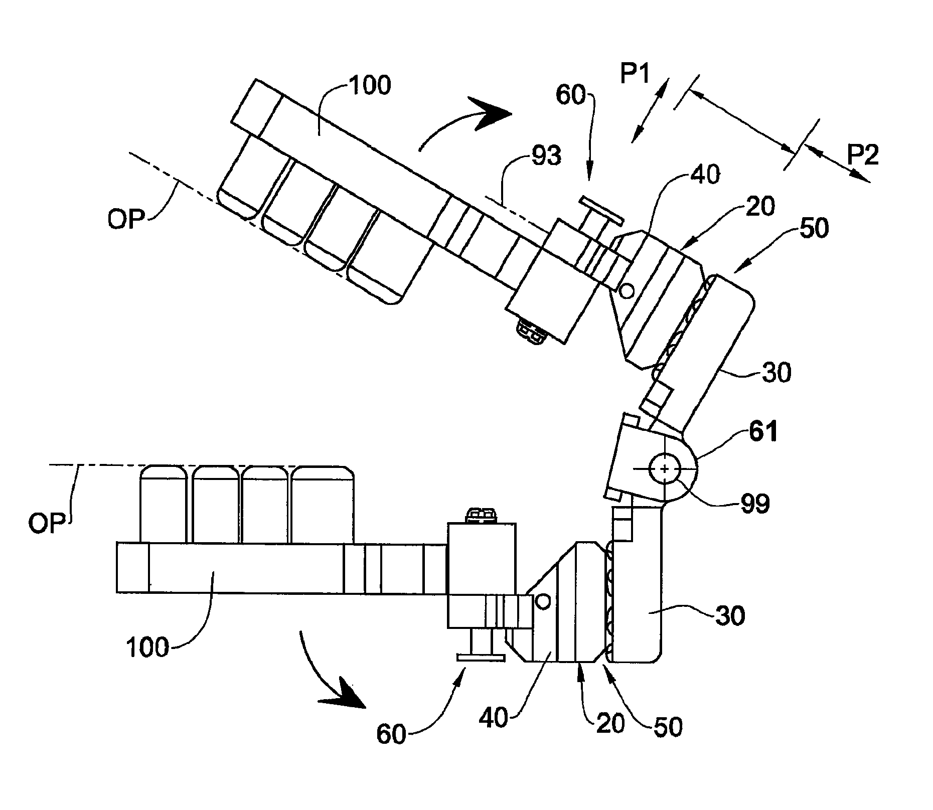 Dental articulator